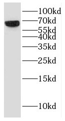 GMPS antibody|GMPS抗体