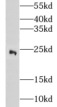 CITED2 antibody|CITED2抗体 FNab0