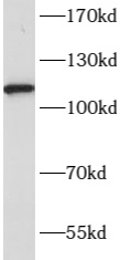 NLRP3 antibody|NLRP3抗体 FNab101