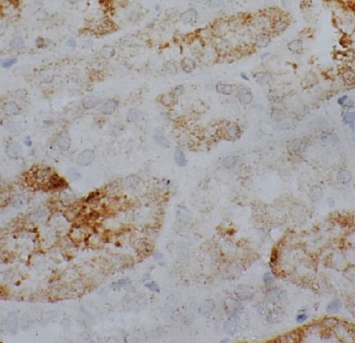 GNA13 antibody|GNA13抗体