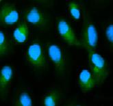 AHSG antibody|AHSG抗体 FNab09916