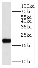 NUDT11 antibody|NUDT11抗体