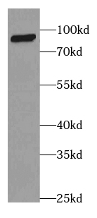 CFB antibody|CFB抗体 FNab01854