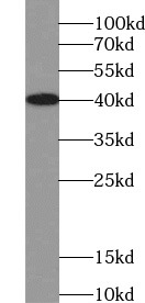 GYPA antibody|GYPA抗体 FNab03509