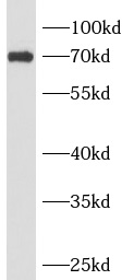 ANKRD13B antibody|ANKRD13B抗体