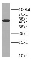 EIF4A3 antibody|EIF4A3抗体 FNab0