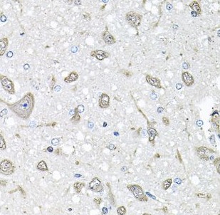 FGF1 antibody|FGF1抗体