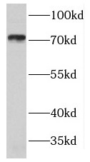GUCY1B1 antibody|GUCY1B1抗体