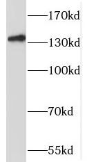 SLC9C2 antibody|SLC9C2抗体