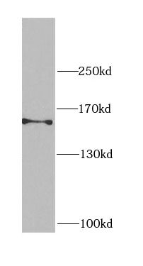 CEP164 antibody|CEP164抗体