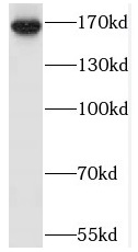 SAMD9L antibody|SAMD9L抗体