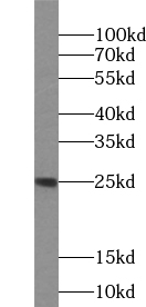 UBE2T antibody|UBE2T抗体