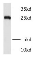 RAB38 antibody|RAB38抗体