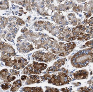 ALDH3A2 antibody|ALDH3A2抗体
