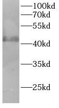 AURKA antibody|AURKA抗体 FNab100