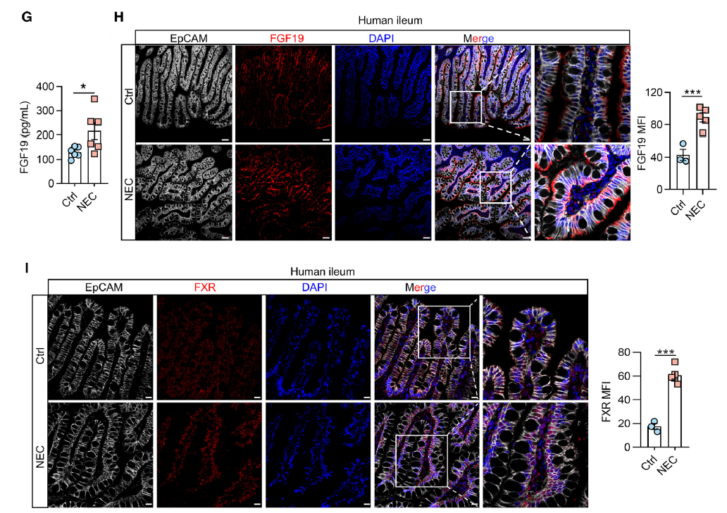【IF 26.3】聚焦新生儿坏死性小肠结肠炎机制：absin 多重荧光免疫组化试剂盒助力胆汁酸受体 FXR 调控肠上皮铁死亡研究