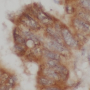 CBLIF antibody|CBLIF抗体 FNab101