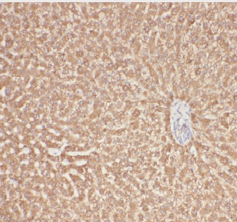 AGT antibody|AGT抗体 FNab00395