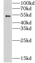 CHRNA1 antibody|CHRNA1抗体