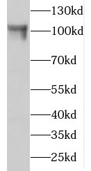 GCC1 antibody|GCC1抗体
