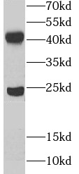 UBE2Z antibody|UBE2Z抗体