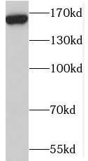 MBD5 antibody|MBD5抗体