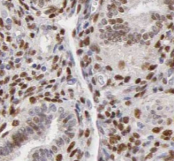 ILF2 antibody|ILF2抗体 FNab05688