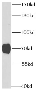 PRKG1 antibody|PRKG1抗体