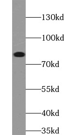 MLH1 antibody|MLH1抗体