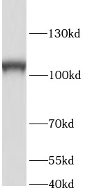 SRBD1 antibody|SRBD1抗体