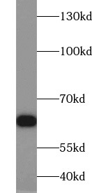 RELA antibody|RELA抗体 FNab06089