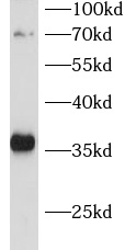 CDCA5 antibody|CDCA5抗体