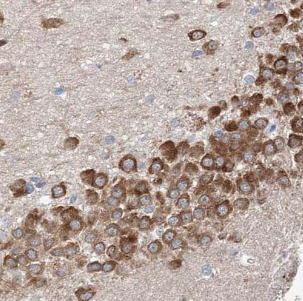 CETN2 antibody|CETN2抗体