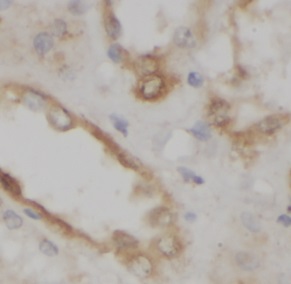 HAS3 antibody|HAS3抗体 FNab10036