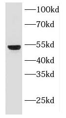 KRT18 antibody|KRT18抗体 FNab022