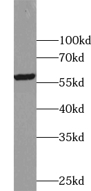 USP3 antibody|USP3抗体