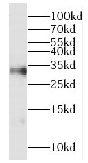 HOXD8 antibody|HOXD8抗体