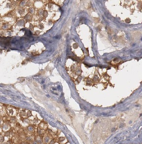 DDR1 antibody|DDR1抗体 FNab10051