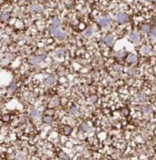 STX7 antibody|STX7抗体