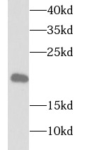 TPPP3 antibody|TPPP3抗体