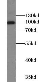 TRPC4 antibody|TRPC4抗体