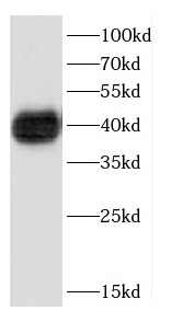 CD8B antibody|CD8B抗体