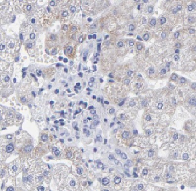 DUSP9 antibody|DUSP9抗体 FNab025