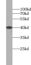 UBXN10 antibody|UBXN10抗体