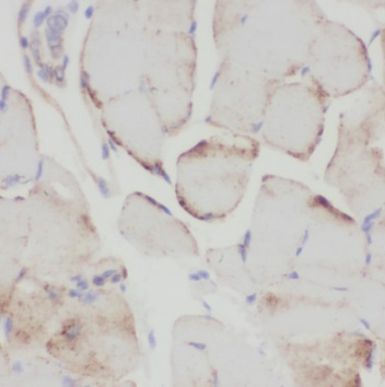 SAR1A antibody|SAR1A抗体 FNab076
