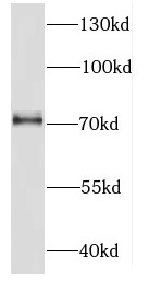 DDX51 antibody|DDX51抗体