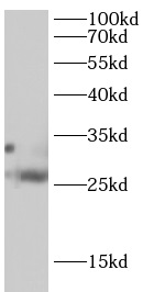 TRADD antibody|TRADD抗体 FNab102