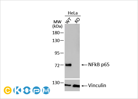文献速递：细胞外基质硬化与睾丸老化及睾酮水平下降相关