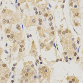 PSMB5 antibody|PSMB5抗体