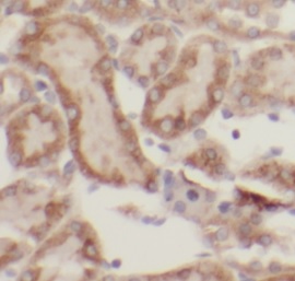 GLA antibody|GLA抗体 FNab00329